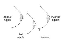 Hasil gambar untuk inverted nipples breastfeeding