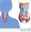 Traitement du cancer de la thyroide