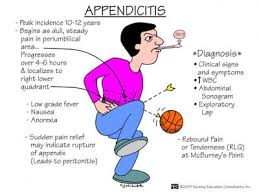 Image result for appendicitis