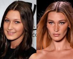 Imagen de Bella Hadid before and after plastic surgery
