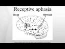 receptive aphasia