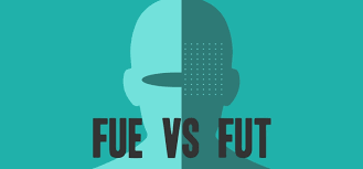 Image result for fut vs fue