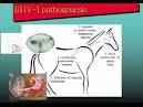 equine herpesvirus