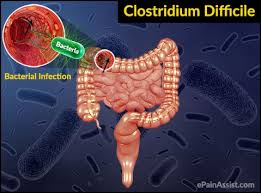 Imagini pentru Clostridium difficile