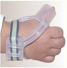 Image result for thermoplastic thumb post for thumb sucking