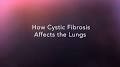 Lung clearance index cystic fibrosis from www.cff.org
