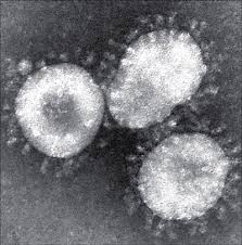 Nuovo virus peggio di Sars : Non è un ''CASO'' ma bensi il'' CAOS''. Images?q=tbn:ANd9GcTotFy7GBNNYW55-9YHenxKVwZWC-GMC2iGkm6l611V1ww3Iuwu