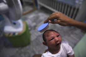 Image result for picture of effects of zika virus